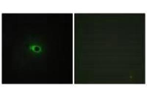 Immunofluorescence (IF) image for anti-Collagen, Type XII, alpha 1 (COL12A1) antibody (ABIN7183370)