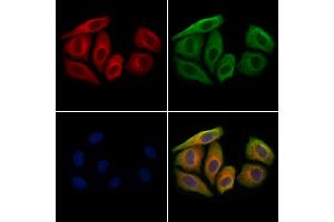 CCL14 Antibody staining Hela cells by IF/ICC. (CCL14 抗体  (Internal Region))