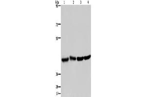 Western Blotting (WB) image for anti-Developmentally Regulated GTP Binding Protein 1 (DRG1) antibody (ABIN2423329) (DRG1 抗体)