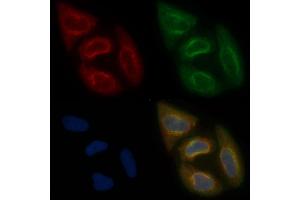 AWAT2 Mouse Monoclonal Antibody staining Hela cells by IF/ICC. (AWAT2 抗体  (Internal Region))