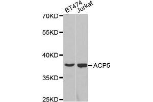 Western blot analysis of extracts of various cell lines, using ACP5 antibody.