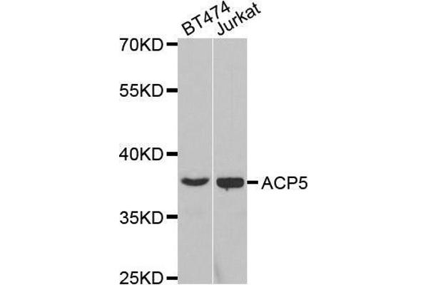 ACP5 抗体  (AA 76-325)