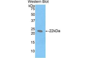 Western Blotting (WB) image for anti-Leukemia Inhibitory Factor (LIF) (AA 25-203) antibody (ABIN1859654) (LIF 抗体  (AA 25-203))