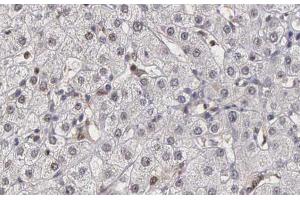 ABIN6266882 at 1/100 staining human liver tissue sections by IHC-P. (DNAJB1 抗体  (C-Term))