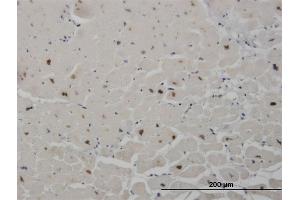Immunoperoxidase of monoclonal antibody to SALL2 on formalin-fixed paraffin-embedded human heart. (SALL2 抗体  (AA 1-198))