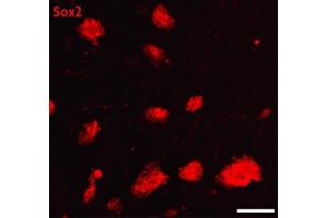 Sox2 antibody (pAb) tested by Immunofluorescence. (SOX2 抗体  (C-Term))