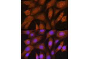 Immunofluorescence analysis of NIH/3T3 cells using GSTT2B Rabbit pAb (ABIN7267450) at dilution of 1:100.