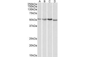 ABIN185314 (1µg/ml) staining of HepG2 (A), Jurkat (B), Mouse Brain (C) and Rat Brain (D) lysates (35µg protein in RIPA buffer). (AKT3 抗体  (AA 119-133))