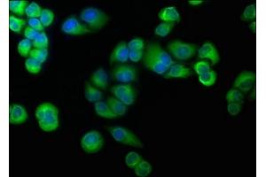 Immunofluorescence staining of Hela cells with ABIN7139839 at 1:166, counter-stained with DAPI. (Foxo6 抗体  (AA 211-218))