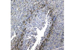 IHC testing of FFPE rat brain tissue with SYT1 antibody at 1ug/ml. (SYT1 抗体)