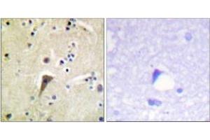 Immunohistochemistry analysis of paraffin-embedded human brain, using FAK (Phospho-Tyr397) Antibody. (FAK 抗体  (pTyr397))