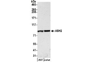 Western Blotting (WB) image for anti-Achaete-Scute Complex Homolog 2 (ASCL2) (AA 50-100) antibody (ABIN7453422)