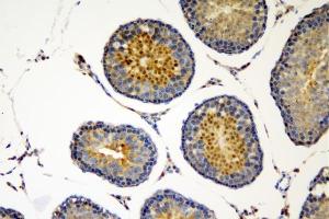 IHC analysis of SOX6 using anti-SOX6 antibody (ABIN7603012). (SOX6 抗体  (Middle Region))