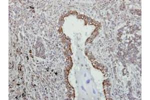 Image no. 1 for anti-VAMP (Vesicle-Associated Membrane Protein)-Associated Protein A, 33kDa (VAPA) (AA 79-92) antibody (ABIN467553) (VAPA 抗体  (AA 79-92))