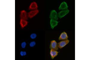ABIN6258699 and ABIN6275026 staining Hela cells(30 min of UV treatment) by IF/ICC. (BEND4 抗体  (Internal Region))