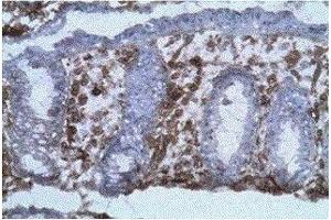 Labelling on frozen section (acetone fixed) of human colic mucosa with B-B20 diluted at 1:100 (background coloration by hematoxylin). (CD40 抗体)