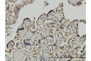 Immunoperoxidase of monoclonal antibody to GTF2I on formalin-fixed paraffin-embedded human placenta. (GTF2I 抗体  (AA 36-274))
