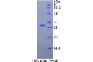 SDS-PAGE analysis of Rat Insulin Like Growth Factor 2 Receptor (IGF2R) Protein. (IGF2R 蛋白)