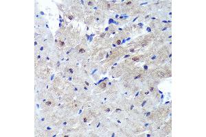 Immunohistochemistry of paraffin-embedded Mouse heart using PSME4 Rabbit pAb  at dilution of 1:100 (40x lens). (PSME4 抗体  (AA 1634-1843))