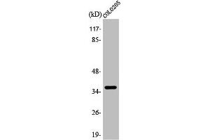 Western Blot analysis of COLO205 cells using Apaf-1-ALT Polyclonal Antibody (APAF1 抗体  (C-Term))