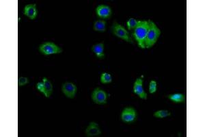 Immunofluorescence staining of HepG2 cells with ABIN7160065 at 1:166, counter-stained with DAPI. (MAP4K2 抗体  (AA 386-469))