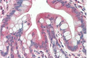 ABIN768661 (5µg/ml) staining of paraffin embedded Human Small Intestine. (TXNDC11 抗体  (AA 113-126))