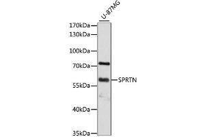 Western blot analysis of extracts of U-87MG cells, using SPRTN antibody (ABIN4905286) at 1:3000 dilution. (Spartan 抗体)