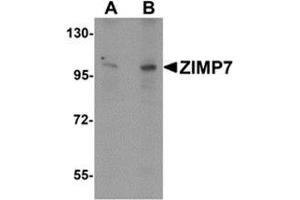 Western Blotting (WB) image for anti-Zinc Finger, MIZ-Type Containing 2 (ZMIZ2) (Center) antibody (ABIN783450)