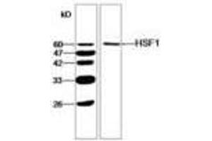 Image no. 1 for anti-Heat Shock Factor Protein 1 (HSF1) antibody (ABIN791450) (HSF1 抗体)