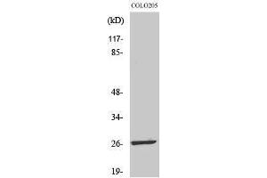 Western Blotting (WB) image for anti-Leucine Zipper, Down-Regulated in Cancer 1-Like (LDOC1L) (Internal Region) antibody (ABIN3185374) (LDOC1L 抗体  (Internal Region))