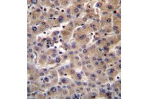 Immunohistochemistry analysis in formalin fixed and paraffin embedded human liver tissue reacted with Beta-glucuronidase Antibody (C-term) followed by peroxidase conjugation of the secondary antibody and DAB staining. (Glucuronidase beta 抗体  (C-Term))
