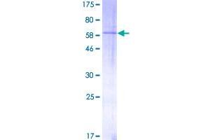 Transforming Growth Factor, beta 1 (TGFB1) (AA 1-390) protein (GST tag)