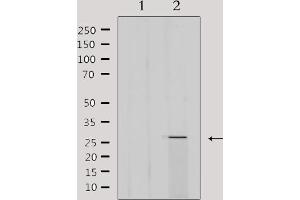 Western blot analysis of extracts from 293, using MRPL16 Antibody. (MRPL16 抗体  (Internal Region))