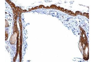 Immunohistochemistry (IHC) image for anti-Stratifin (SFN) antibody (ABIN2854867)