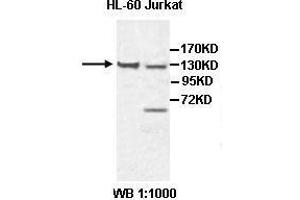 Western blot analysis of HL-60 and Jurkat cell lysate, using CHL1 antibody. (CHL1 抗体  (AA 788-1025))