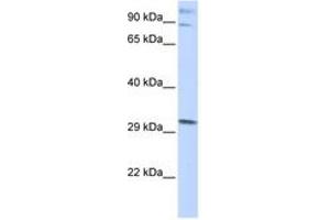 Image no. 1 for anti-Zinc Finger Protein 148 (ZNF148) (AA 684-733) antibody (ABIN6742483) (ZNF148 抗体  (AA 684-733))
