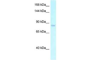 Western Blotting (WB) image for anti-Egf-Like Module Containing, Mucin-Like, Hormone Receptor-Like 2 (EMR2) (N-Term) antibody (ABIN2788897)