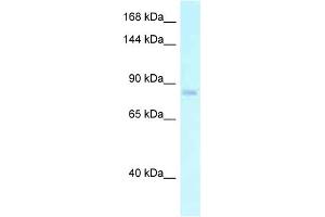 WB Suggested Anti-EMR2 Antibody Titration: 1. (EMR2 抗体  (N-Term))