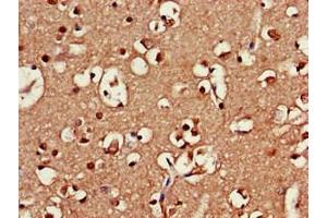 Immunohistochemistry of paraffin-embedded human brain tissue using ABIN7168941 at dilution of 1:100