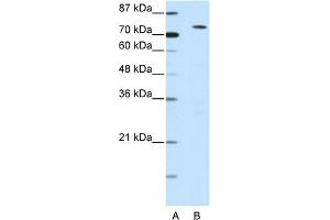 WB Suggested Anti-MYST2 Antibody Titration:  0. (MYST2 抗体  (N-Term))