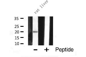 Western blot analysis of JM4 expression in Rat liver lysate (PRAF2 抗体  (C-Term))