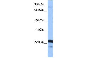 SFRS9 antibody used at 1 ug/ml to detect target protein. (SFRS9 抗体  (Middle Region))