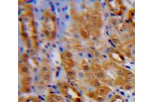 IHC-P analysis of Kidney tissue, with DAB staining. (IL1RL1 抗体  (AA 162-349))