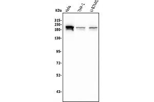 Western blot analysis of SMARCA2/BRM using anti-SMARCA2/BRM antibody (ABIN7600366).