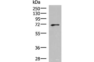 Western blot analysis of PC3 cell lysate using GSPT2 Polyclonal Antibody at dilution of 1:600 (GSPT2 抗体)