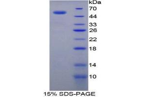 SDS-PAGE (SDS) image for Transglutaminase 1, Keratinocyte (TGM1) (AA 504-737) protein (His tag,GST tag) (ABIN1879486)