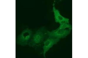Anti-BEST3 mouse monoclonal antibody (ABIN2452805) immunofluorescent staining of COS7 cells transiently transfected by pCMV6-ENTRY BEST3 (RC218436). (Bestrophin 3 抗体)