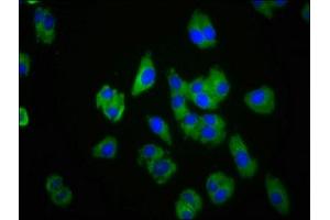 Immunofluorescence staining of HepG2 cells with ABIN7147549 at 1:100, counter-stained with DAPI. (CMKLR1 抗体  (AA 321-373))