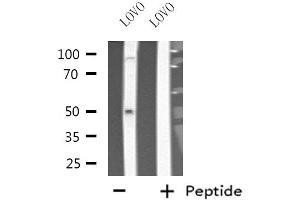 Western blot analysis of extracts from LOVO cells, using Cytochrome P450 3A7 antibody.