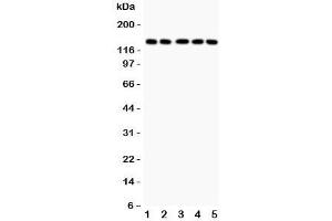 Western blot testing of Collagen Type 2 antibody and Lane 1:  COLO320;  2: HeLa;  3: MCF-7;  4: A549;  5: Jurkat lysate. (COL2A1 抗体  (C-Term))
